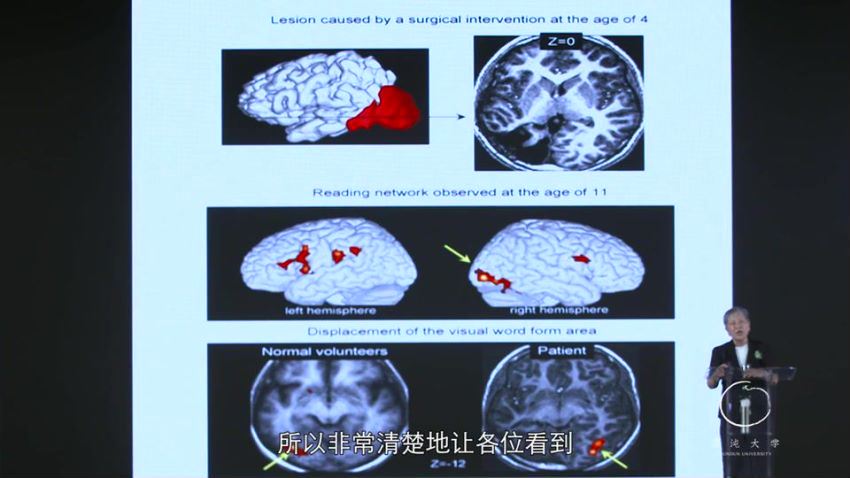 混沌大学(文理学院)：洪兰《认知神经科学》 网盘分享(331.40M)